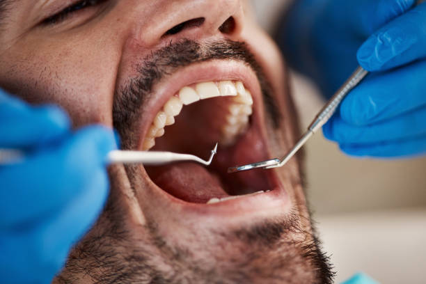 Best Cracked Tooth Emergency Dentist  in Terrace Heights, WA